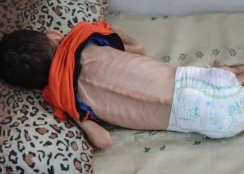 الجوع يفتك بأرواح الأبرياء.. 5 شهداء جدد بينهم طفلان في غزة