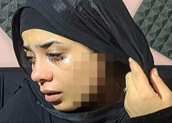 “41 غرزة في الوجه”.. تفاصيل تعدي سيدة على خطيبة طليقها بـ”الموس”