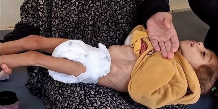 الأمم المتحدة: الوضع الإنساني للأطفال في قطاع غزة كارثي