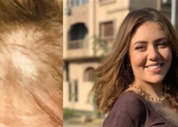 رحمة حسن في رسالة مؤثرة بعد تساقط شعرها بسبب خطأ طبي: ارتكبوا في حقي جريمة