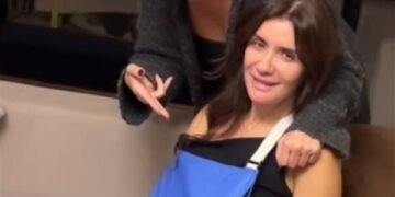 تعرّضت الفنانة غادة عادل لكسر في ذراعها، حيث ظهرت رفقة الإعلامية إنجي علي وهي تدعمها أثناء تحركها. وكانت غادة عادل قد كشفت مؤخرًا عن خضوعها لعملية تجميل، مؤكدة أنها قامت بحقن الفيلر الدائم خلال السنوات الماضية، مما سبب لها بعض المشكلات، مشددة على أنها طلبت من الطبيب عدم تغيير ملامح وجهها. وقالت في تصريحات تلفزيونية: “أحلى حاجة في العملية إنها بترجعك أصغر، مش بتغير فيكي حاجة… أنا قولت للدكتور إني مش عايزة أبان متغيرة، ولا أحلى من الطبيعي”. وأضافت أنها بعد إزالة الفيلر عاد شكل وجهها كما كان طبيعيًا. وعن حياتها العاطفية، كشفت غادة عادل عن استعدادها لدخول علاقة جديدة، موضحة: “الحب موجود طول الوقت… لو لاقيت إنسان يستحق أكيد هحبه… أحب الطيبين واللي عندهم رحمة وعطاء ومفيش مصالح”. على الصعيد الفني، يُعرض حاليًا فيلم فيها إيه يعني، وهو آخر أعمالها، ويشاركها البطولة الفنان ماجد الكدواني، مصطفى غريب، ريتال عبد العزيز، أسماء جلال، من إخراج عمر رشدي.