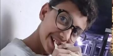 "الصحة" تمنح الأمل للشاب جلال وتتبنى علاجه لاستعادة نعمة الإبصار