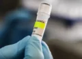 إسرائيل تسجل أول إصابة مؤكدة بفيروس هانتا