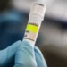 إسرائيل تسجل أول إصابة مؤكدة بفيروس هانتا