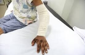 إصابة موظف وفقده إصبعًا في مشاجرة بكرداسة