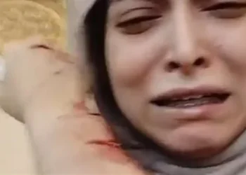 أول تعليق من طبيبة أسنان زعمت الاعتداء عليها داخل مركز طبي في شبرا الخيمة
