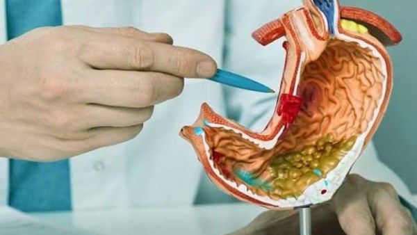 احذر تجاهلها.. طبيب يكشف علامات جرثومة المعدة ومخاطر تركها دون علاج