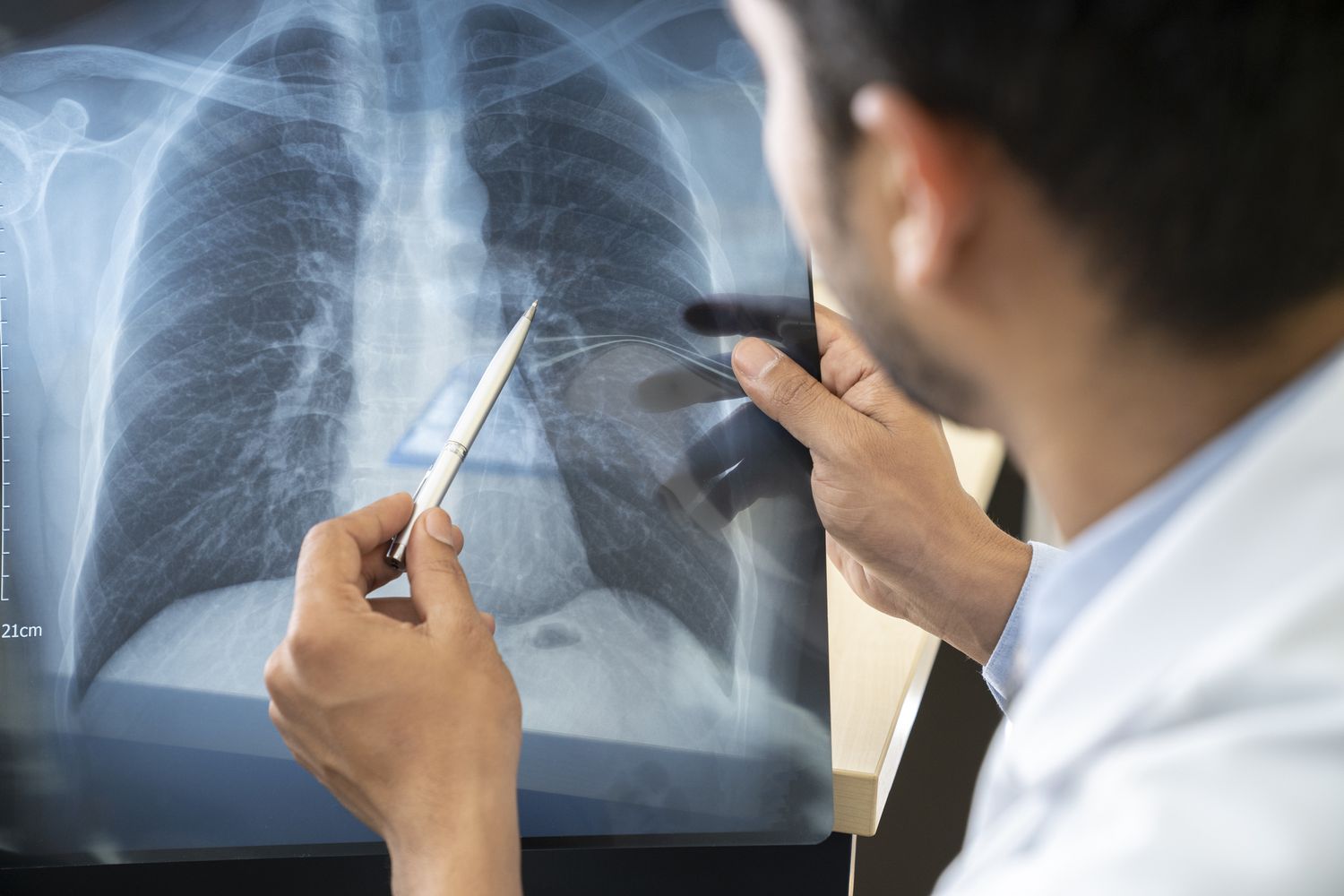 الصحة تحذر: 4 علامات قد تكشف أمرًا خطيرًا في الرئة